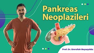 Pankreas Neoplazileri