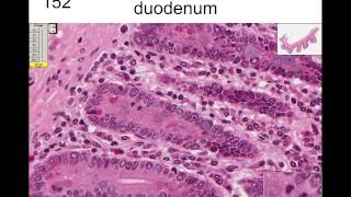 5. Nucleus and Mitosis