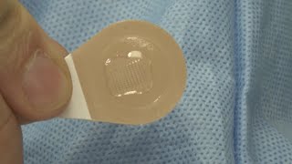 Flu vaccine skin patch could someday replace shots