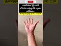 கை விரல்கள் மரத்து போதல் மணிக்கட்டு வலி carpal tunnel syndrome