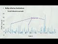 should you use the kelly criterion for trading