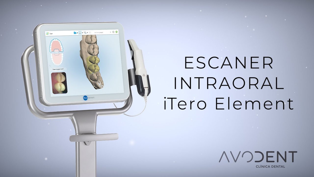 Escáner Intraoral ITero Element: ¿qué Ventajas Tiene? - Clínica Dental ...