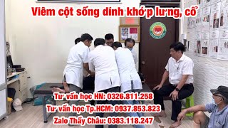 Viêm cột sống dính khớp lưng, cổ