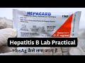 HBsAg test | Hepatitis B virus | Hepatitis B surface antigen test | Hepatitis B Practical