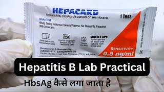 HBsAg test | Hepatitis B virus | Hepatitis B surface antigen test | Hepatitis B Practical