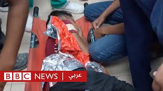 رفح: بي بي سي داخل مستشفى بعد القصف الإسرائيلي على مخيم اللاجئين | بي بي سي نيوز عربي