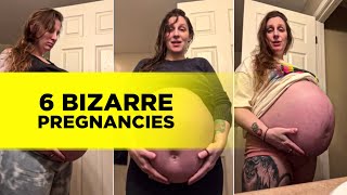 6 Bizarre Pregnancy Cases That Will Leave You Astonished