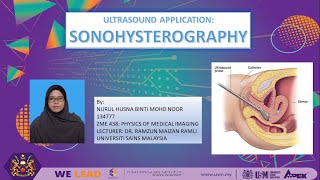 Ultrasound Application: Sonohysterography