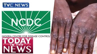 NCDC Refutes Claims of Monkey Pox Outbreak as FG, ASUU Resume Negotiation