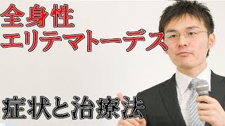 49全身性エリテマトーデスの症状・治療について