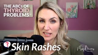 The ABCs of Thyroid Problems - SKIN RASHES