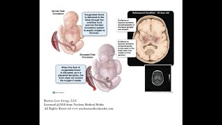 HIE And Seizures