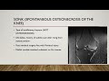 Musculoskeletal radiology review - PART 1  (Crack the core revision presentation)