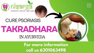 takradhara an ayurvedic panchakarma procedure done in scalp psoriasis #trending