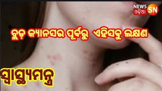 ବ୍ଲଡ଼ କ୍ୟାନସର ପୂର୍ବରୁ ଏହିସବୁ ଲକ୍ଷଣ  ଦେଖାଯାଏ||NewsSNodia ||Swasthyamantra||Bloodcancer