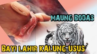 Inilah Keistimewaaan Bayi lahir memiliki Kalung Usus Dan kelebihannya#ghoib#misteri#kalungusus#viral