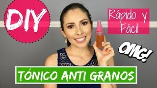 DIY: TÓNICO ANTI GRANOS / Rápido, Fácil y Muy Efectivo | Karla Biebrich