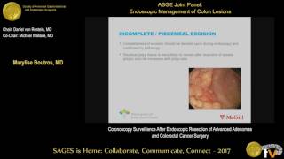 Colonoscopy surveillance after endoscopic resection of advanced adenomas \u0026 CRC surgery