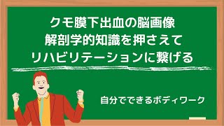 クモ膜下出血の脳画像 解剖学的知識を押さえて、リハビリテーションに繋げる