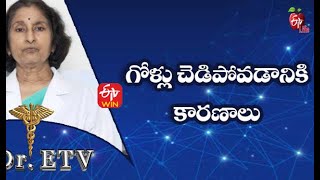 Causes of Nail Damage | గోళ్లు చెడిపోవడానికి కారణాలు | Dr.ETV | 25th October 2021 | ETV Life