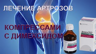 Постановка компресса с Димексидом на коленный сустав#лечитьартроз#димексид#компрессынасуставы