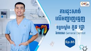 កម្មវិធីសុខភាពមាត់ធ្មេញ | Ep. 85 ប្រធានបទ៖ ការដុះសាច់លើអញ្ចាញធ្មេញ