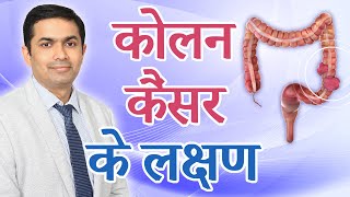 कोलन कैंसर के लक्षण | Signs \u0026 Symptoms of colon cancer in Hindi