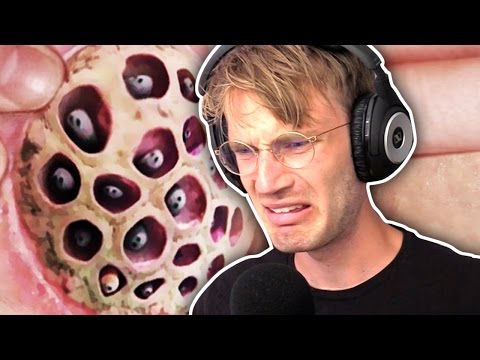 (WARNING GROSS) CURING MY TRYPOPHOBIA (WARNING GROSS) CURING MY TRYPOPHOBIA