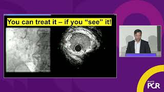 From angiography to precision PCI: integrating ACIST Pro and HD IVUS imaging - EuroPCR 2026