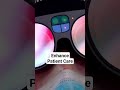 Spatial Medical Imaging in Augmented Reality