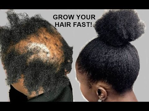 YOUR HAIR WILL GROW LIKE CRAZY GROW HAIR Long, Thick & Healthy FAST! YOUR HAIR WILL GROW LIKE CRAZY GROW HAIR Long, Thick & Healthy FAST!