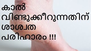 കാൽ വിണ്ടുക്കീറുന്നതിന് ശാശ്വത പരിഹാരം !!! Cracked heels-Causes symptoms and remedies !!!