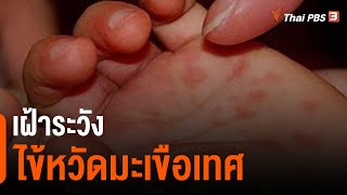 เฝ้าระวังไข้หวัดมะเขือเทศ | จับตาสถานการณ์ | 29 ส.ค. 65