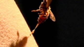 Bee Therapy | National Geographic