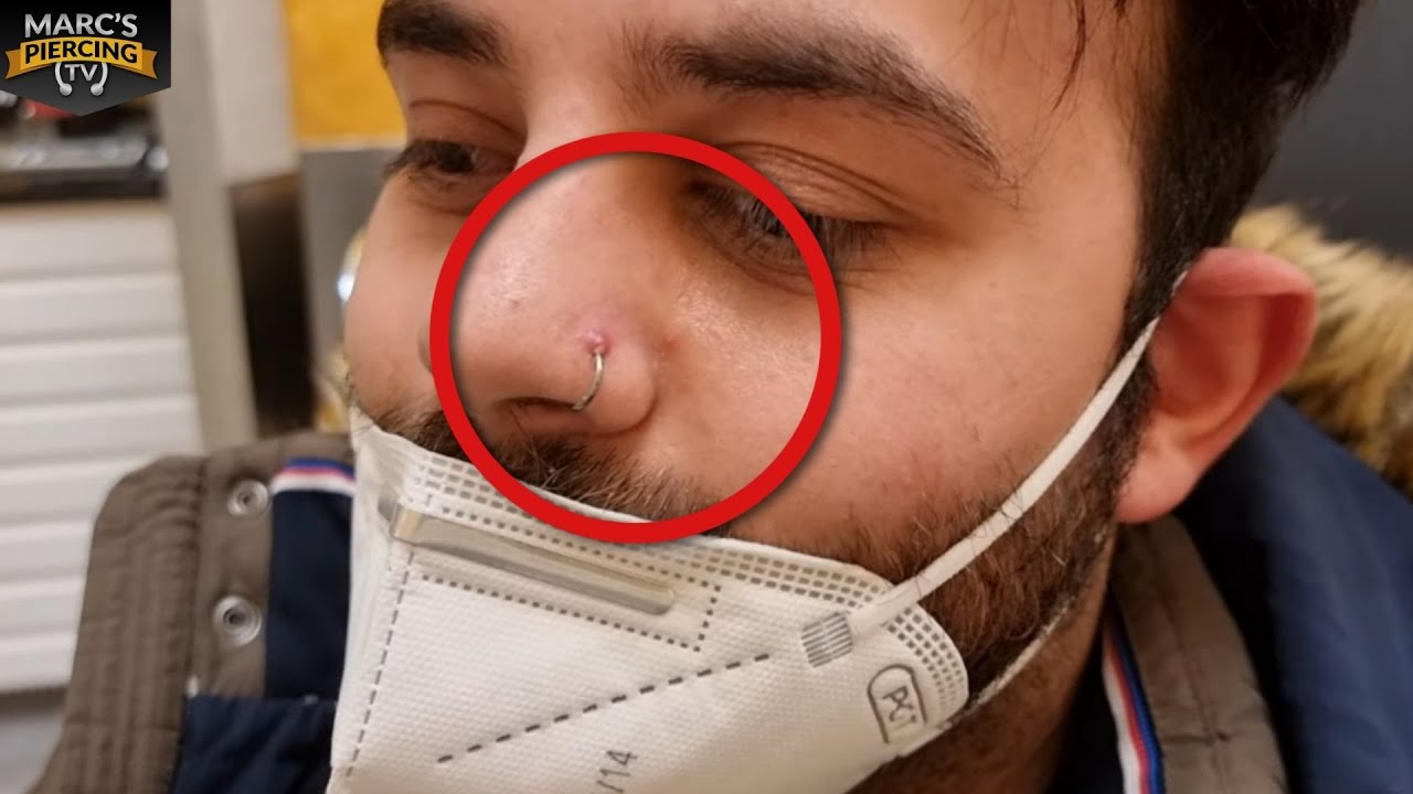 Piercing Fail Voll Entzﾃｼndetes Nasenpiercing 忠 Marc S Piercing Tv