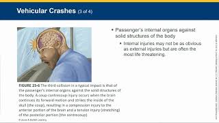 EMT/AEMT Trauma Overview