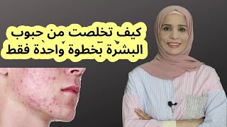 علاج حب الشباب \ تجربتي الشخصية مع نظام الكيتو