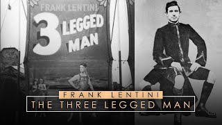 Frank Lentini | The Three Legged Man