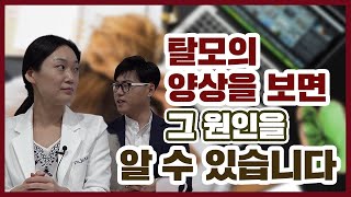 탈모의 양상을 보면 그 원인을 알수 있습니다.