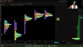 Bank Nifty Prediction \u0026 Analysis | 17 Oct 24 Thursday | Market Profile Trading