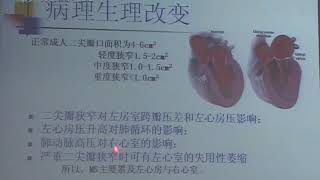 36 教学录像 心脏瓣膜疾病教学录像1 同济医学院 内科学