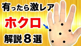 【手相】手に出たら人生を変えるホクロ８選【黒子占い】