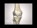 Knee Replacement Prosthetics - Medical Animation