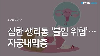 심한 생리통 ‘불임 위험’…자궁내막증 / YTN 사이언스