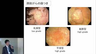 膀胱がん「講義」上川 禎則 先生（大阪市立総合医療センター 泌尿器科）【大阪オンコロジーセミナー Meeting the Cancer Experts  第7回】