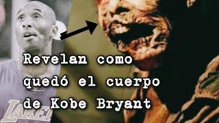 Kobe Bryant, ASÍ QUEDÓ SU CUERPO- Imágenes reales y perturbadoras de su autopsia- Giana Maria- NBA