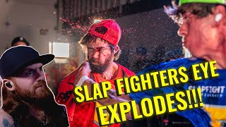 Crowd SHOCKED as Slap Fighter's Eye EXPLODES 🫣