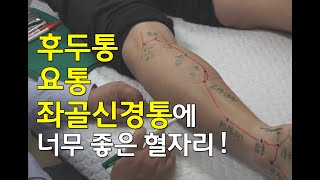 [김효열 교수의 재미있는 혈자리 공부] 후두통, 요통, 좌골신경통에 너무 좋은 혈자리(족태양방광경)