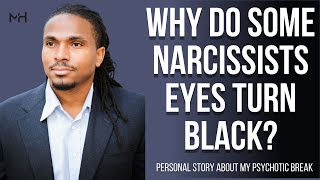 why do some narcissist eyes turn black? | The Narcissists' Code Ep 653