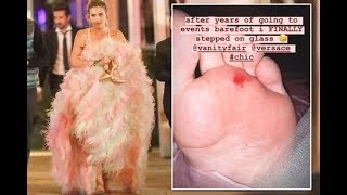 Paris Jackson gets bloody wound on foot after standing on glass at Oscar's party